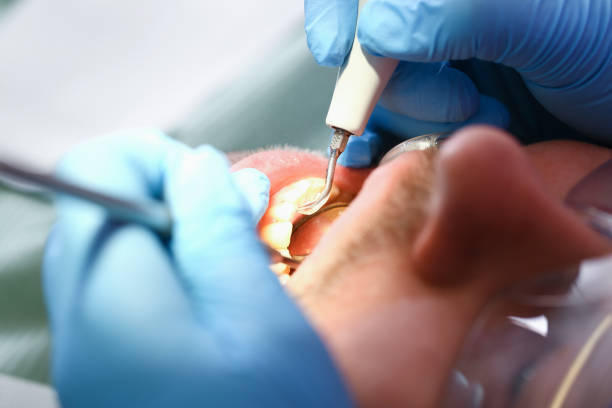 Best Pediatric Emergency Dentist in Belle, MO