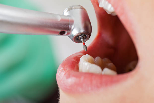 Best Emergency TMJ Treatment in Belle, MO